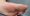 Person with Calluses under foot