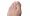 Fungal Toenail