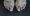 “Cross Over Toe” (Hammertoe) on black background.