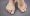 Feet Of Woman Deformed From Rheumatoid Arthritis. Macro