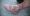 psoriatic-arthritis-1-670x384